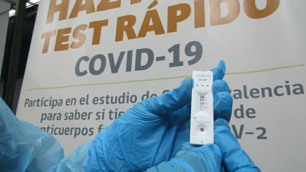 Habilitan stand para la toma de test de antígenos que detecta presencia de anticuerpos contra el covid-19
